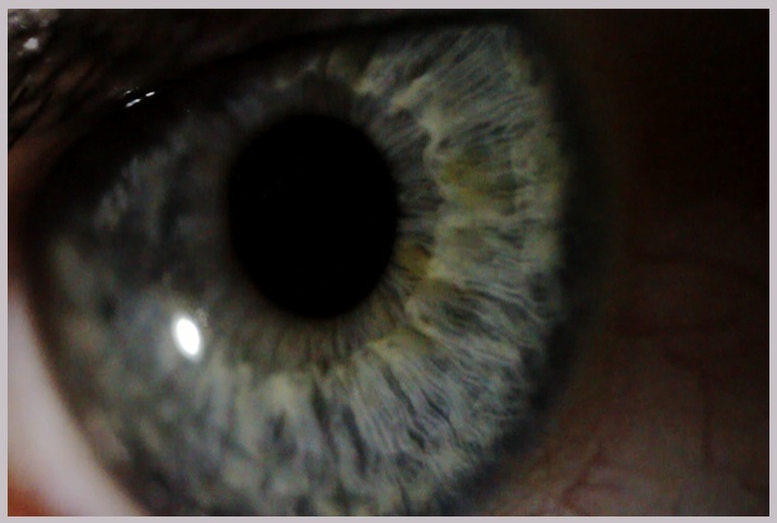 Day 264 / My Friends And Their Eyes